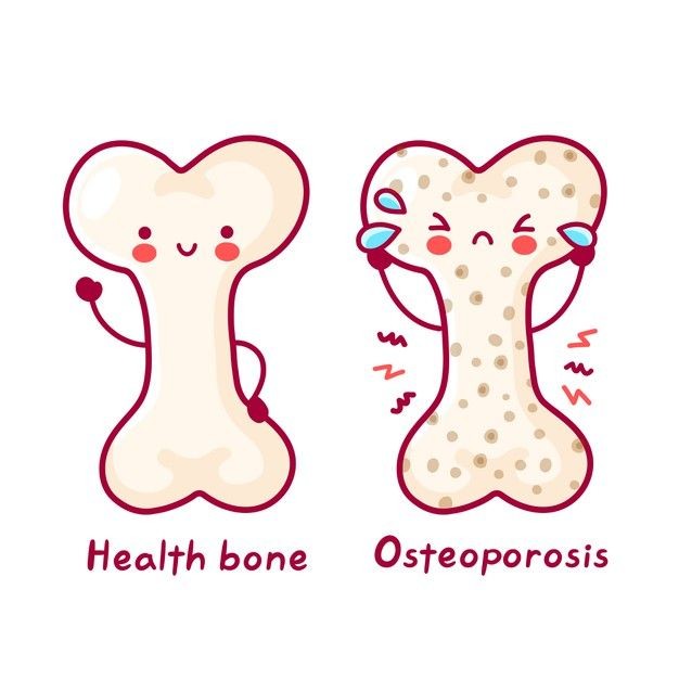 Osteoporosis